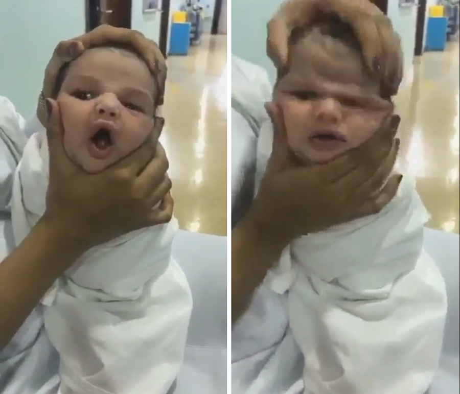 الوالد فوجئ بتناقل مقطع فيديو خاص بابنه...ممرضات &quot;يعذِّبن&quot; رضيعاً وسط ضحكات ساخرة في السعودية