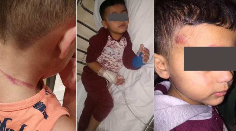 بالصور / صفحة رأس بيروت تنشر صوراً لطفل يتعرض للضرب الوحشي بعد تعنيفه من قبل (زوجة الاب)