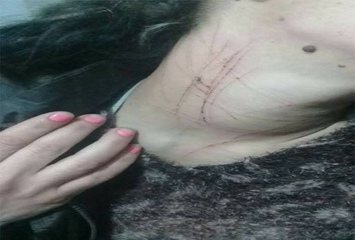 زوج يعتدي بوحشية على زوجته في طرابلس...شطّب جسدها بزجاجة!