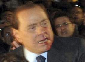 شاب يضرب رئيس الوزراء الايطالي على وجهه ونقله للمستشفى Picture