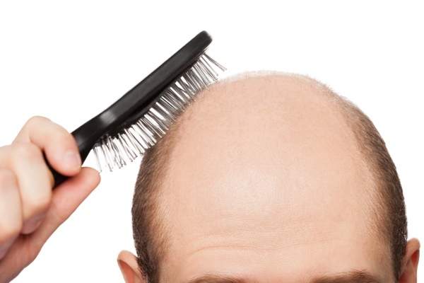 طرائق فعالة للوقاية من الصلع ولعلاج تساقط الشعر