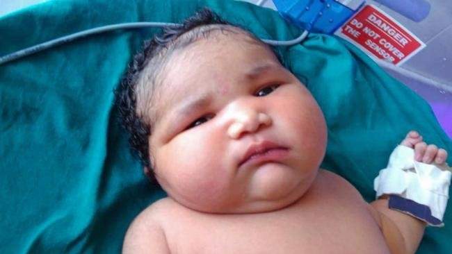بالفيديو و الصور / ولادة أثقل مولودة في العالم.. كم بلغ وزنها؟ 
