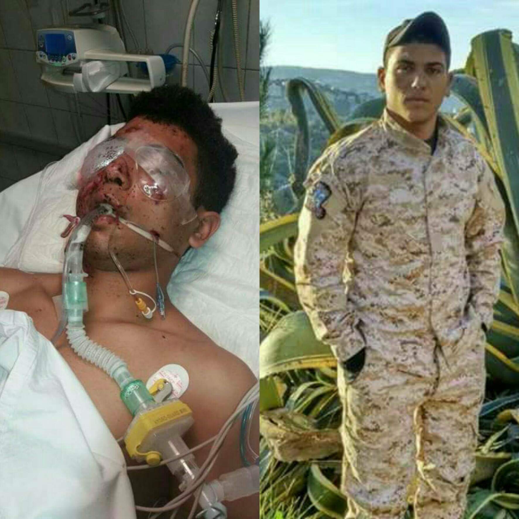 إبن بلدة برقايل بطل من أبطال الجيش اللبناني .. قدم عيونه للوطن ! 