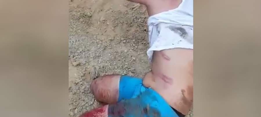 اعتداء وحشي على شاب من آل زعيتر في منطقة صحراء الشويفات