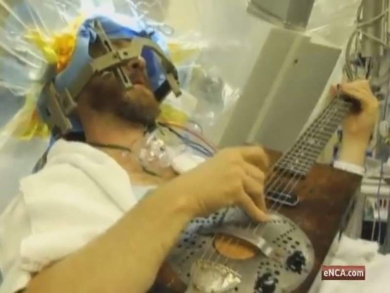 بالفيديو.. موسيقي يعزف أثناء خضوعه لعملية جراحية بالدماغ!
