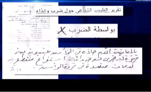 بالفيديو: اتهم المستشفى بالتقصير تجاه زوجته.. فتبين أنه حاول قتلها!