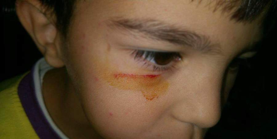 ابن السبع سنوات يتعرض للضرب في إحدى مدارس طرابلس