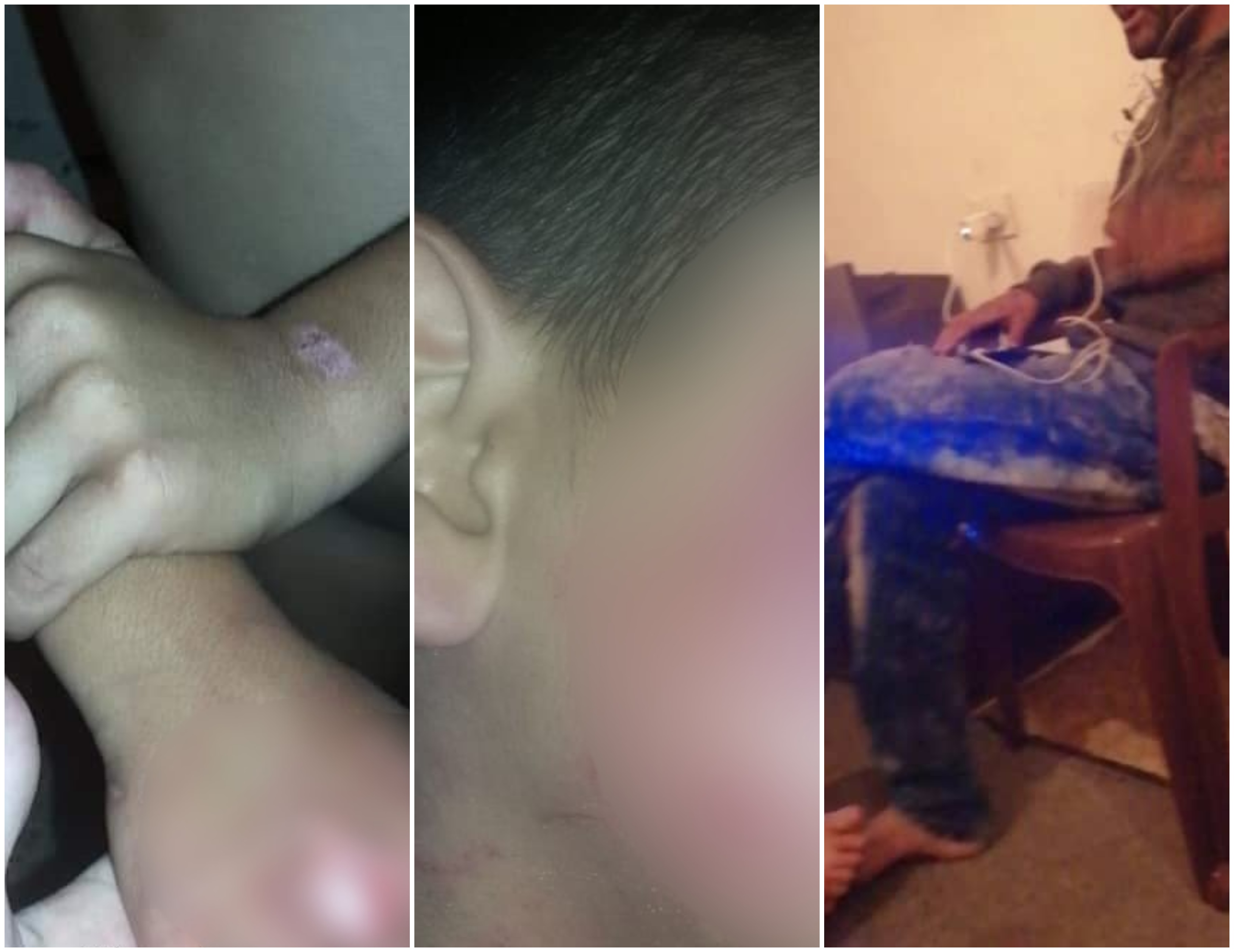 بالصور/ وحش بشري عذب أطفاله بالنار وشوه أجسادهم بعد خلافات مع زوجته في منطقة البرج