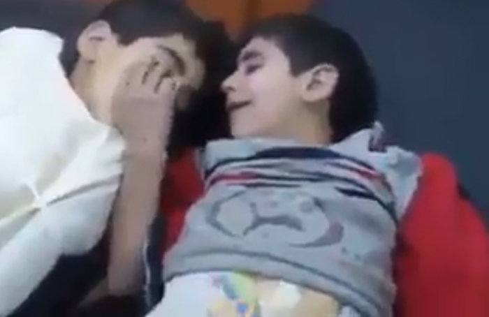 مشهد يكسر القلب...طفل يمني جريح يودع أخاه الصغير الذي قضى متأثراً بإصابته