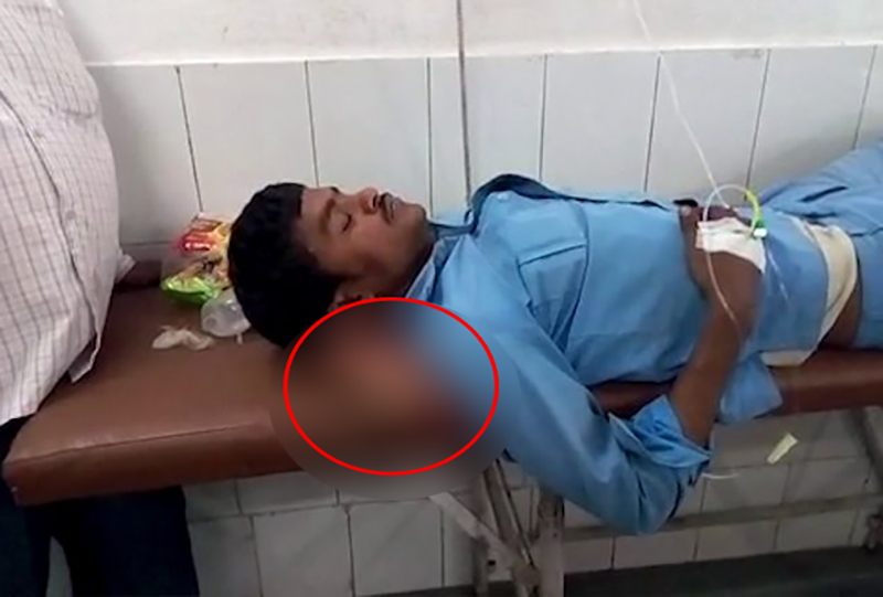 صورة قاسية تثير الجدل...رجل مبتورة تتحول لـ &quot;وسادة&quot; في مستشفى حكومي في الهند!