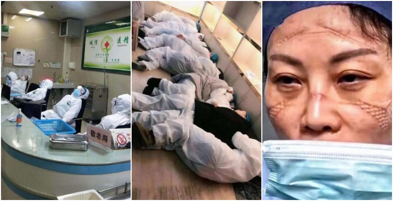 مشاهد مؤثرة لأطباء صينيين يعملون ليلا ونهارا لمكافحة &quot;كورونا&quot;.. هيستيريا وأيام بلا نوم وأحدهم توفي بسكتة قلبية بعد عمله لـ10 أيام متواصلة