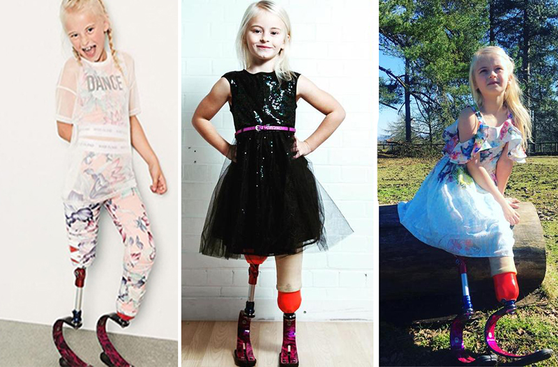 الطفلة ديزي، مبتورة الساقين وشاركت في عروض أزياء للصغار لتثبت للعالم أنها ليست مختلفة!