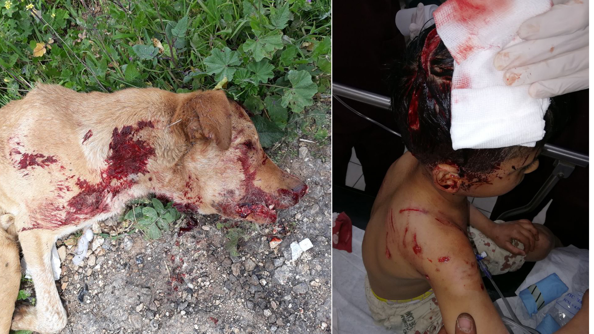 إصابة 3 مواطنين بينهم طفل حالته خطيرة بعدما هاجمهم كلب مسعور في بلدة الدوير 